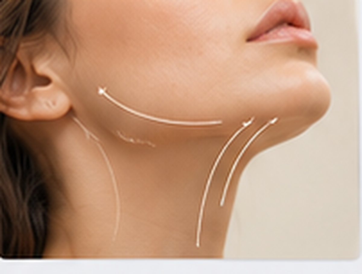 Vanished Double Chin Jawline Approach
